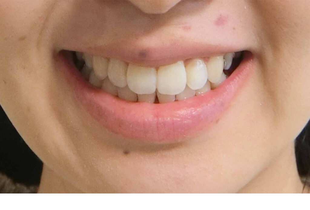 34歳の女性｜実例写真あり