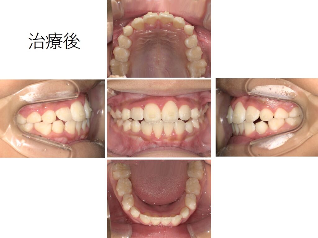 7歳3か月の男子｜実例写真あり