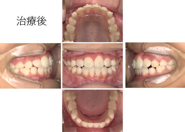 7歳3か月の男子｜実例写真あり